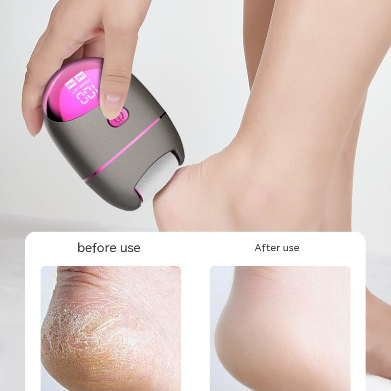 Electric Foot Grinder Get Rid Of Foot Skin Dead Skin Calluses Cuticle Pedicure Device Pedicure Device
