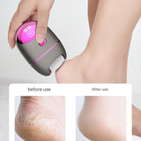 Electric Foot Grinder Get Rid Of Foot Skin Dead Skin Calluses Cuticle Pedicure Device Pedicure Device